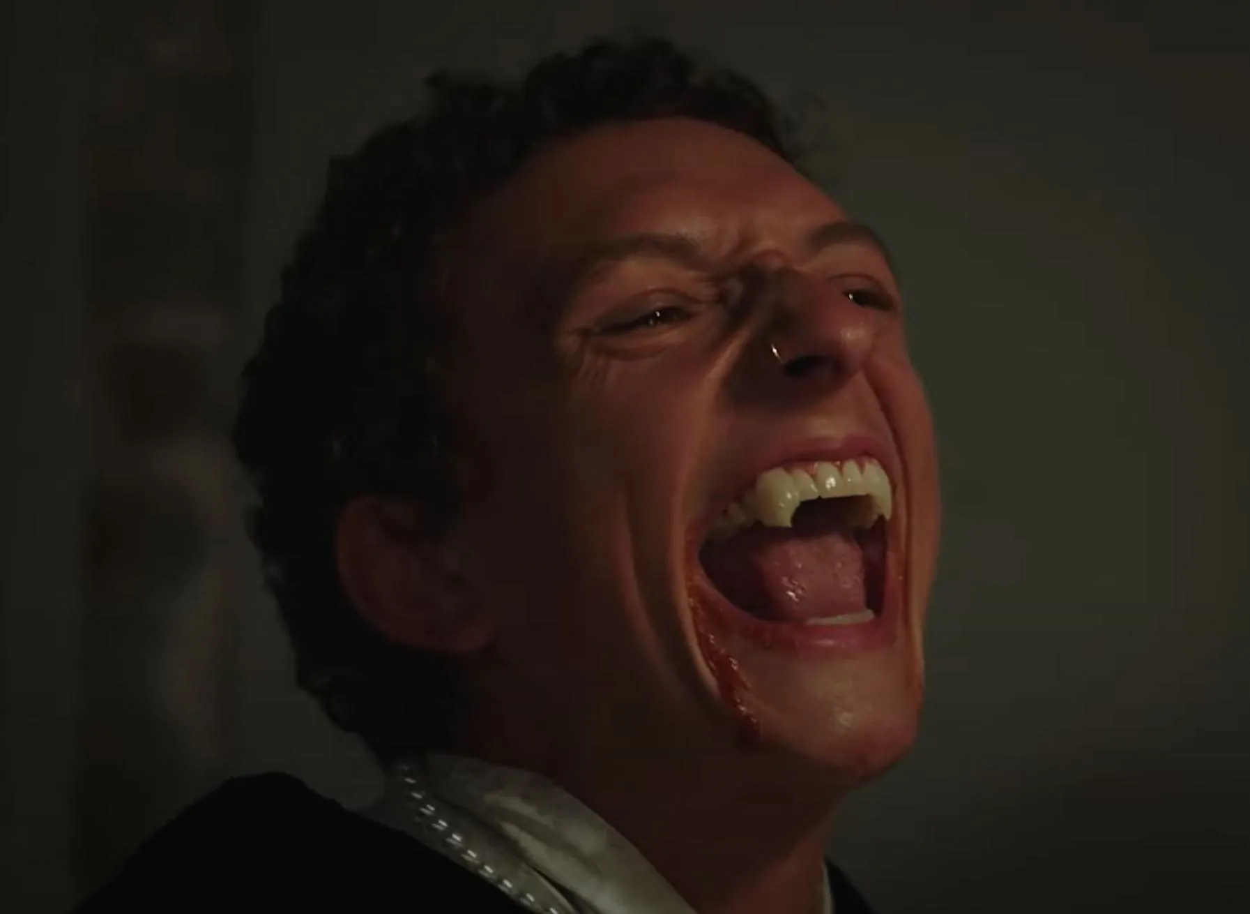 Toby, laughing, with blood on his chin.